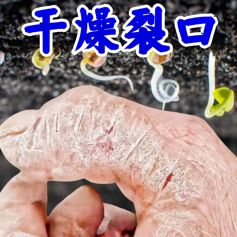 草本不刺激手足脱皮干裂修复霜