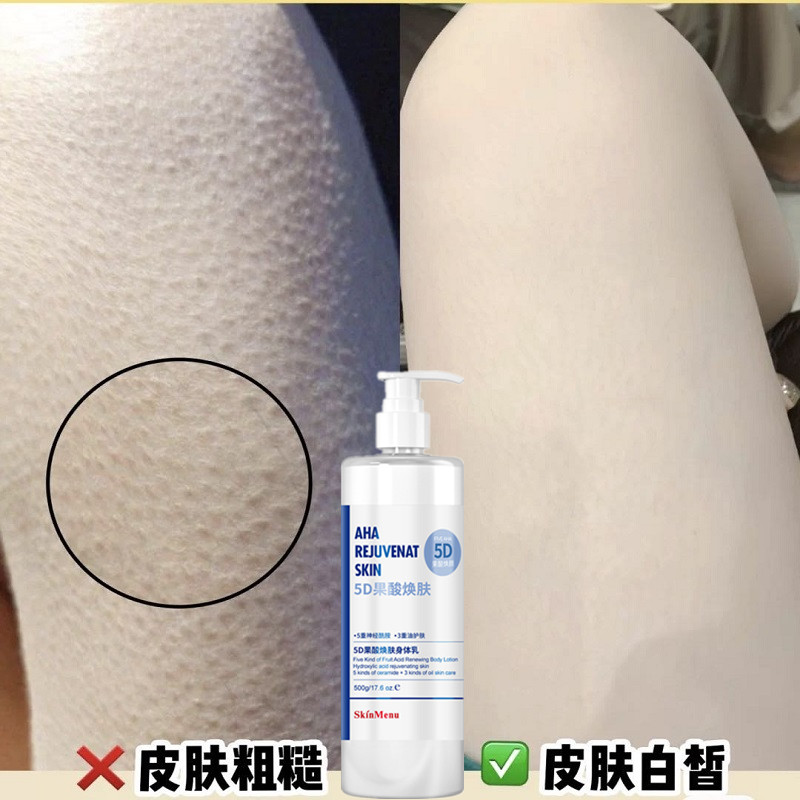 去毛周角化好的身体乳(毛周角化症用什么身体乳) 去毛周角化好的身体乳(毛周角化症用什么身体乳)