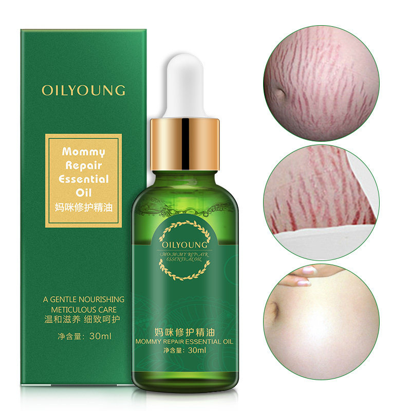 [乌龟晒太阳复方精油]正品去妊娠纹修复霜产后紧致提拉肥胖生月销量5件仅售69元