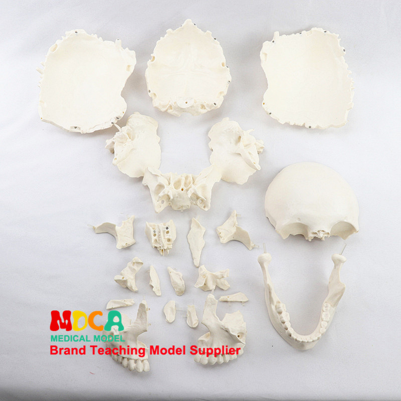 의료 분할 22 부품 1:1 인간 기본 색상 두개골 모델 두개골 색상 두개골 교육 MTG014
