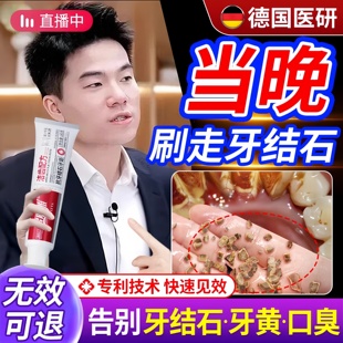 牙膏速效洗白去黄去口臭美白烟渍溶解牙垢清除神器专用去除牙结石