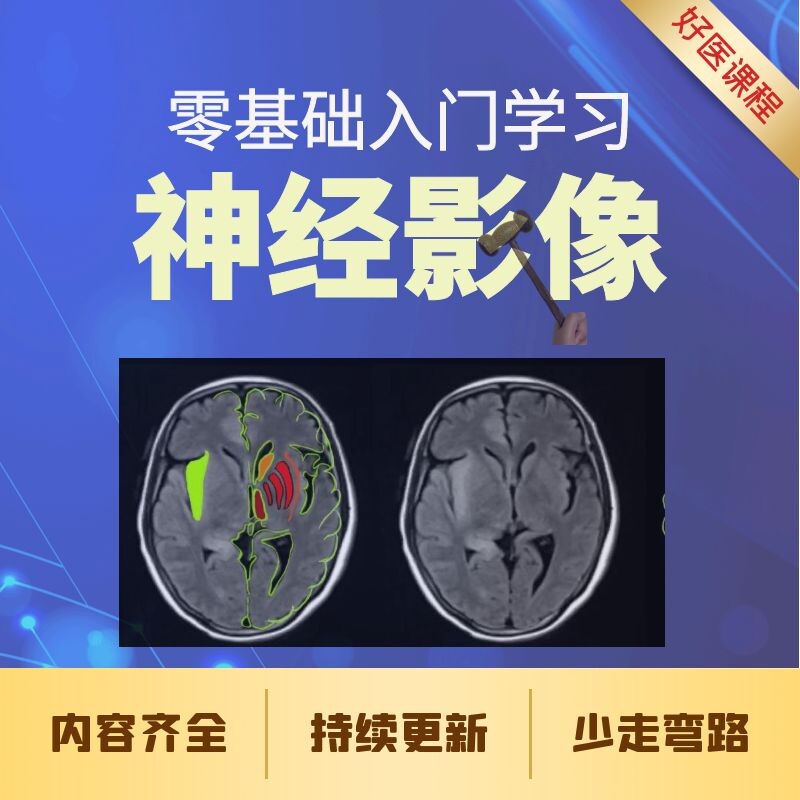 零基础入门学习神经影像视频课程颅脑解剖肿瘤脑梗临床诊断教程