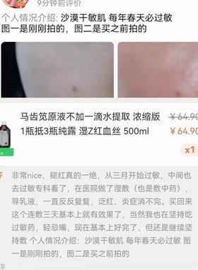 敏感发热脸痒退红湿敷马齿笕原液