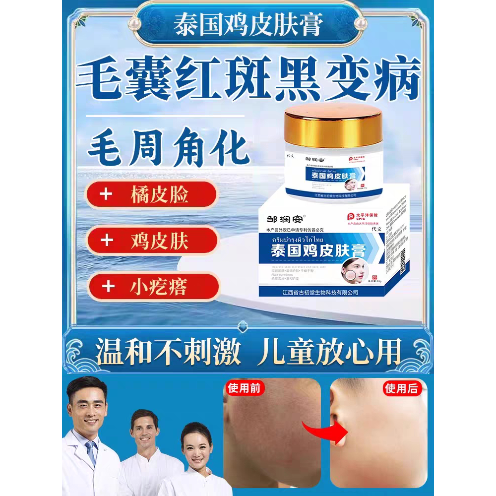 泰国鸡皮肤膏去角质皮肤死皮疙瘩手臂缩小颗粒毛囊修复膏