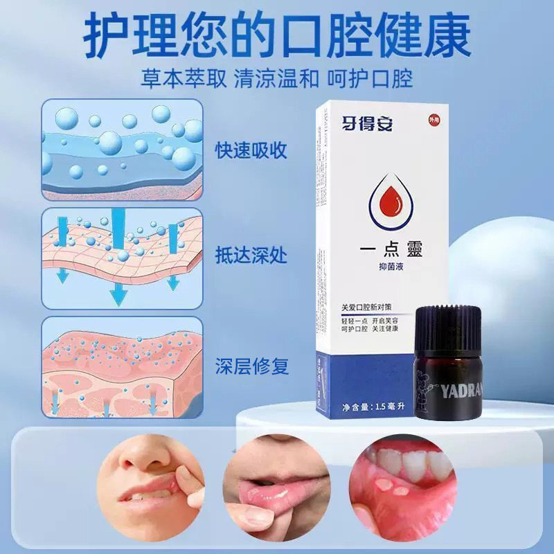 牙得安一点灵口腔嘴巴不适起泡上火口腔粘膜