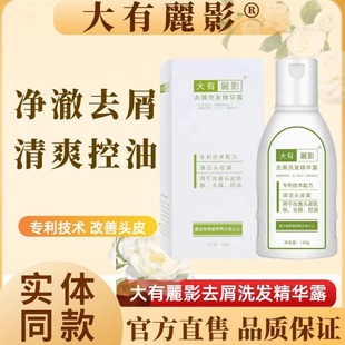大有丽影去屑洗发精华去屑止痒洗发露控油抗真菌除螨洗发水专业