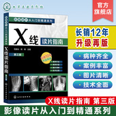 阅片技巧 影像读片入门 医学影像 影像读片从入门到精通系列 影响剖析 影像读片 X线诊断 影像鉴别诊断应用书籍 X线读片指南第三版
