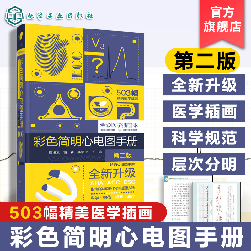 彩色简明心电图手册 心电图基础知识 心电图导联系统 常用心电图术语 常用心电图技能与房室肥厚 常见器质性心脏病 临床医师参考书