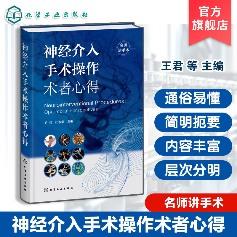 神经介入手术临床实战指南