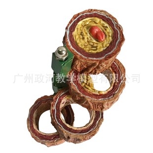 人体支脉粥样硬化血管形成模型 血栓血管模型血液科动mai硬化模型