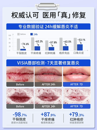 [Горячая продажа № I] Губная помада липстрит 99%.