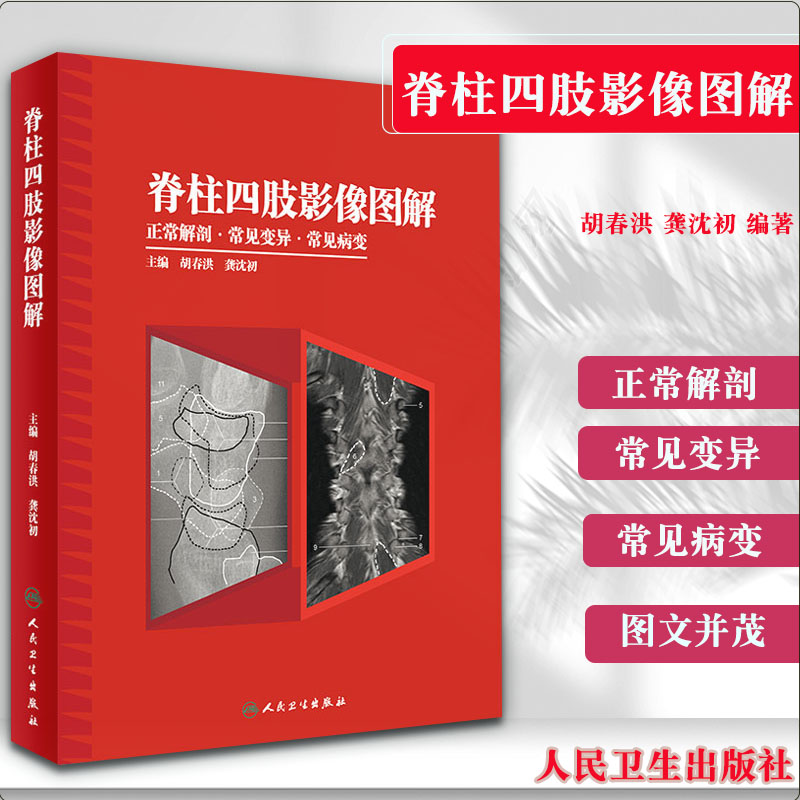 脊柱四肢影像图解 正常解剖·常见变异·常见病变胡春洪龚沈初主编影像图解放射医学解剖学临床医学影像实用书籍人民卫生出版社 书籍/杂志/报纸 影像医学 原图主图