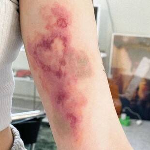 爱心淤青病态美学彩色纹身贴女防水持久手臂学生款一次性可洗贴纸