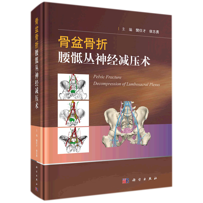 骨盆骨折腰骶丛神经减压术(精) 博库网