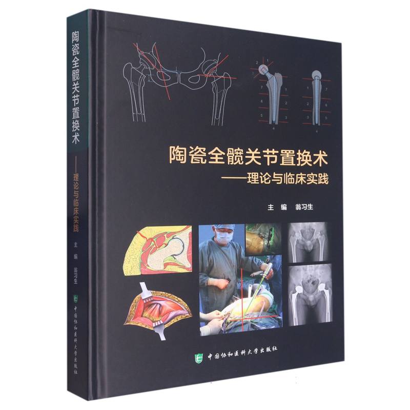 陶瓷全髋关节置换术——理论与临床实践 博库网
