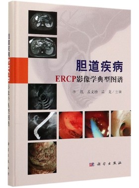 胆道疾病ERCP影像学典型图谱(精) 博库网