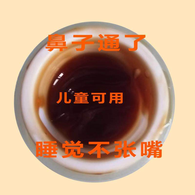 秦赢堂和膏通鼻神器鼻塞鼻痒流鼻涕打喷嚏鼻干打喷嚏