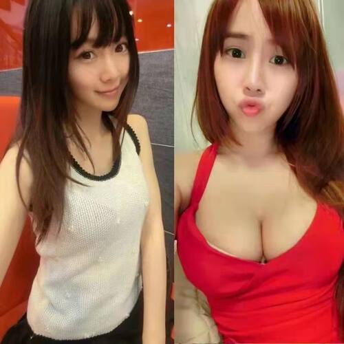 女性增胸价格 女性增胸图片 星期三