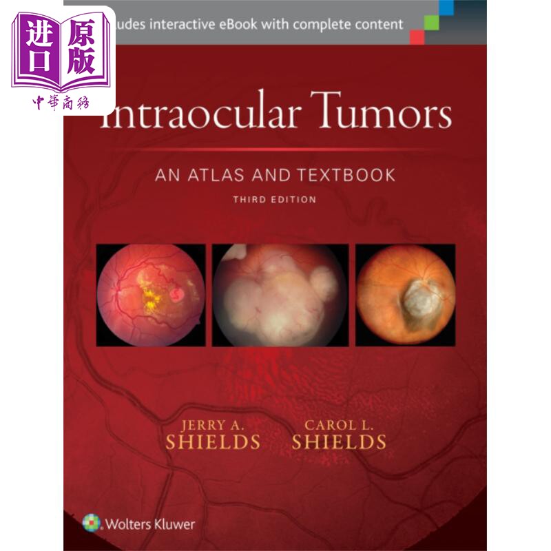 现货 眼内肿瘤 图解及教材 第3版 英文原版 Intraocular Tumors Jerry A Shields【中商原版】