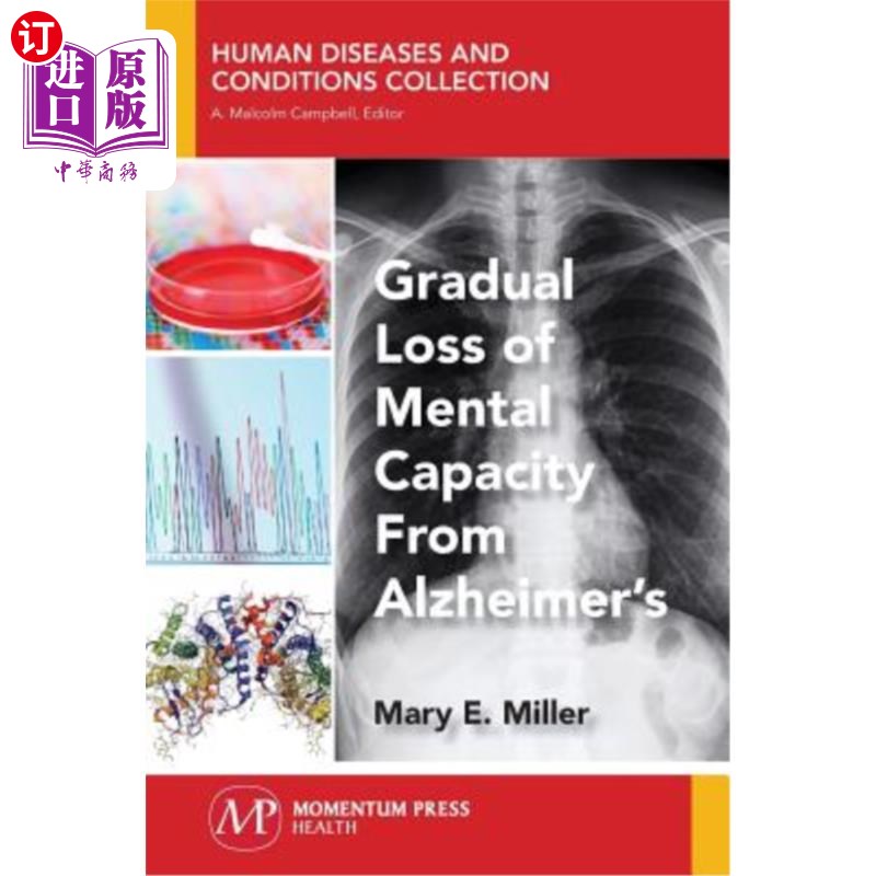 海外直订Gradual Loss of Mental Capacity from Alzheimer's 阿尔茨海默病导致的心智能力逐渐丧失