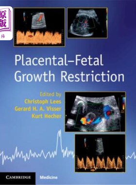 海外直订医药图书Placental-Fetal Growth Restriction 胎盘胎儿生长受限