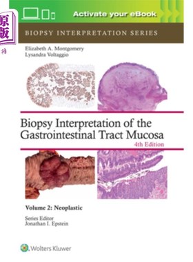 海外直订医药图书Biopsy Interpretation of the Gastrointestinal Tract Mucosa Volume 2: Neoplastic: 胃肠道粘膜的活检解