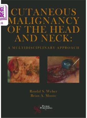 海外直订医药图书Cutaneous Malignancy of the Head and Neck: A Multidisciplinary Approach 头颈部皮肤恶性肿瘤的多学科