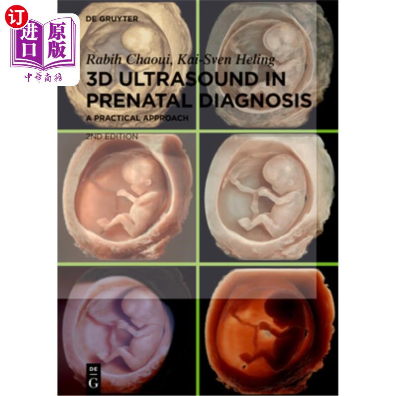 海外直订医药图书3D Ultrasound in Prenatal Diagnosis: A Practical Approach 三维超声在产前诊断:一个实用的方法
