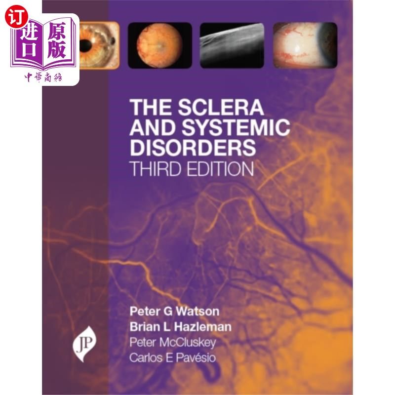 海外直订医药图书The Sclera and Systemic Disorders 巩膜与全身疾病