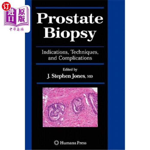 海外直订医药图书Prostate Biopsy: Indications, Techniques, and Complications 前列腺活检：适应症、技术和并发症