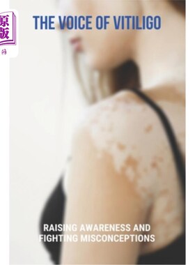 海外直订医药图书The Voice Of Vitiligo: Raising Awareness And Fighting Misconceptions: Tips On Fi 白癜风之声:提高意