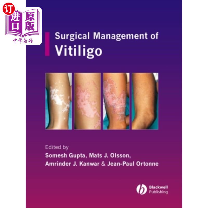 海外直订医药图书Surgical Management of Vitiligo 白癜风的外科治疗