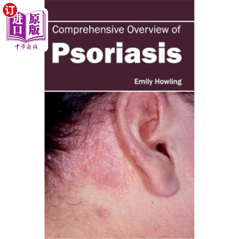 海外直订医药图书Comprehensive Overview of Psoriasis 银屑病综述