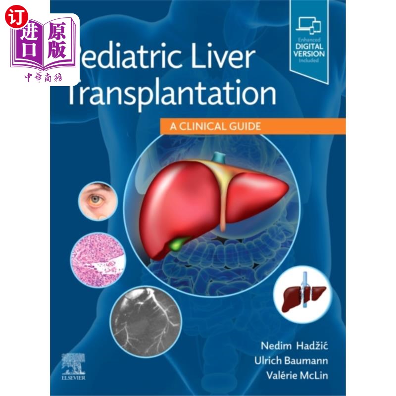 海外直订医药图书Pediatric Liver Transplantation 小儿肝移植