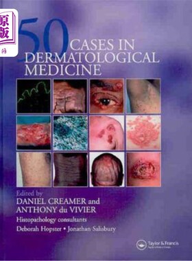 海外直订医药图书Fifty Dermatological Cases 皮肤病50例