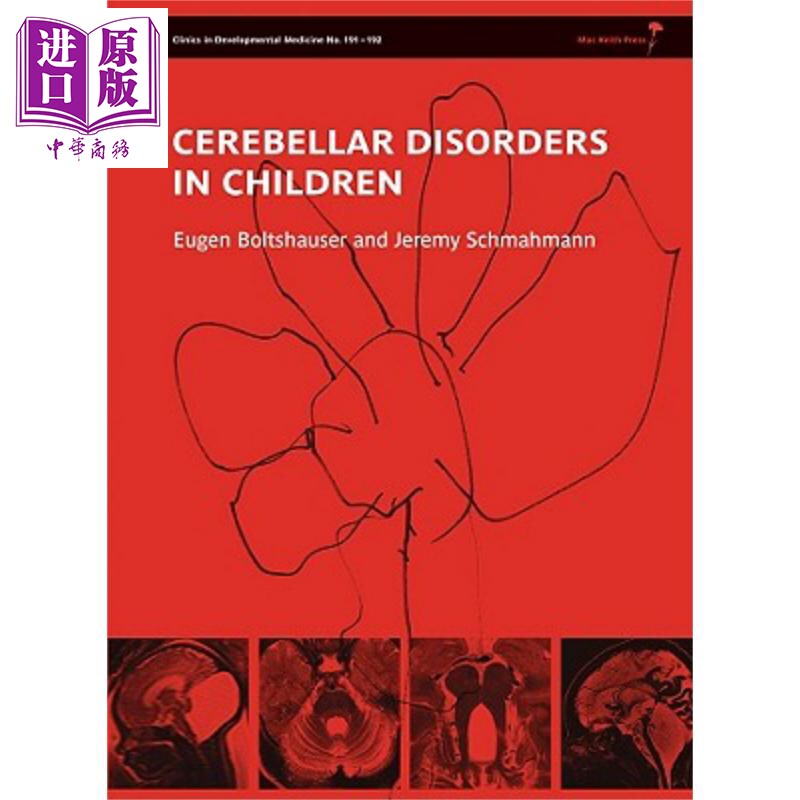 现货 儿童小脑疾病 新版本 Cerebellar Disorders In Children 英文原版 Eugen Boltshauser【中商原版】 wiley