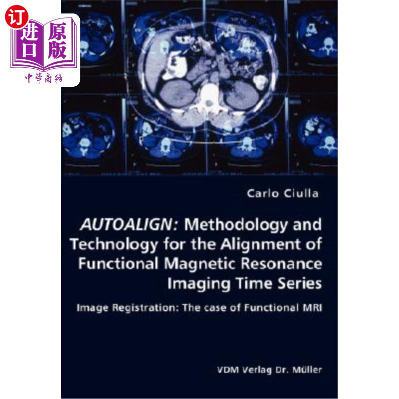 海外直订医药图书Autoalign: Methodology and Technology for the Alignment of Functional Magnetic R 自动校准：功能性磁