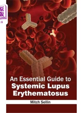 海外直订医药图书Essential Guide to Systemic Lupus Erythematosus 系统性红斑狼疮基本指南
