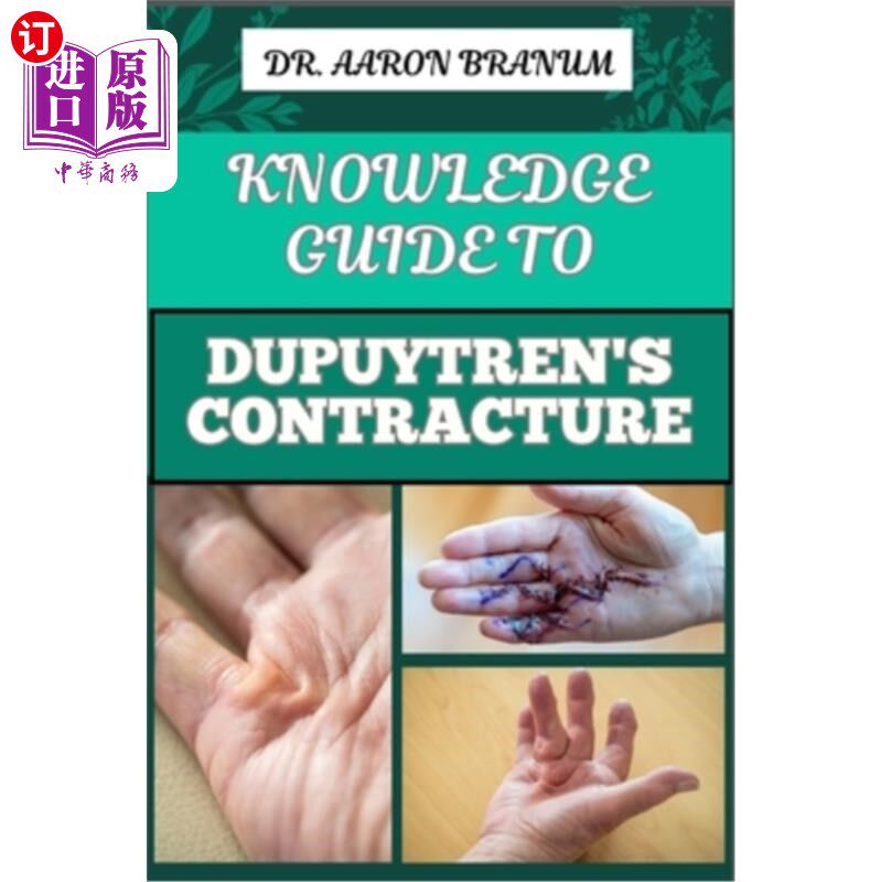 海外直订医药图书Knowledge Guide to Dupuytren's Contracture: Comprehensive Manual To Symptoms, Tr 知识指南Du