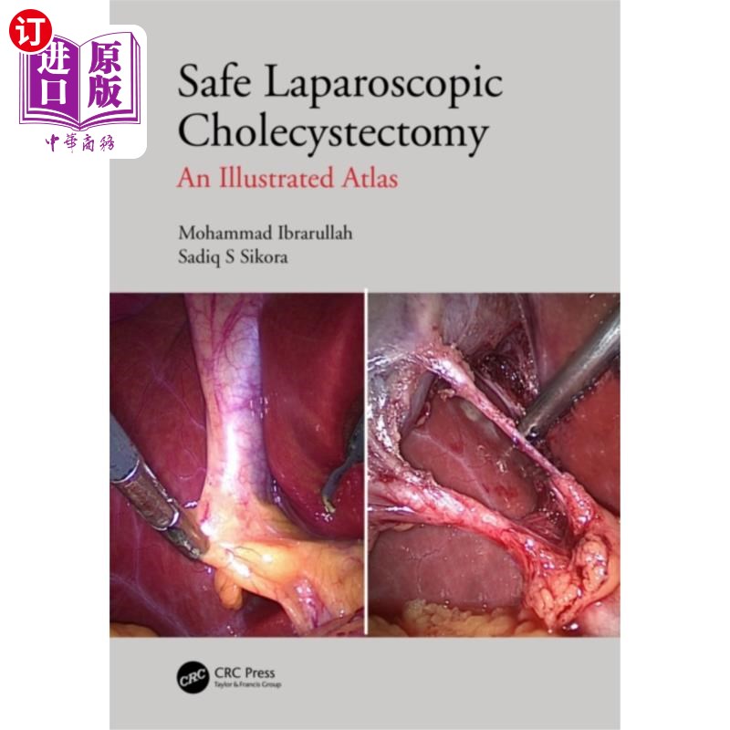 海外直订医药图书Safe Laparoscopic Cholecystectomy 安全的腹腔镜胆囊切除术
