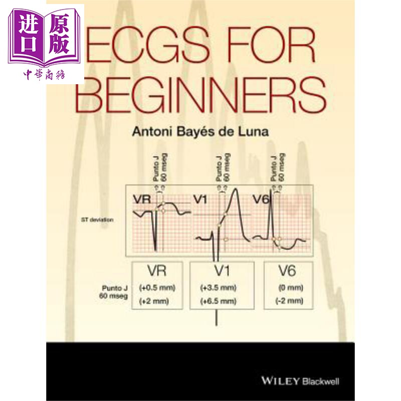 现货 心电图 初学者教程 Ecgs For Beginners 英文原版 Antoni Bayés de Luna 中商原版