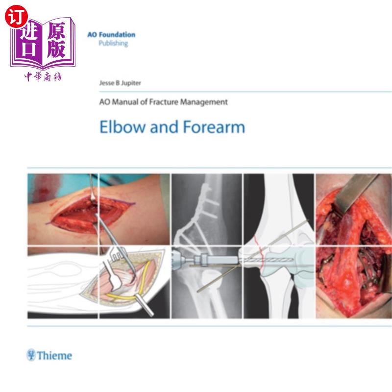 海外直订医药图书AO Manual of Fracture Management - Elbow & Forearm AO骨折管理手册-肘部和前臂