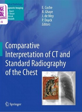 海外直订医药图书Comparative Interpretation of CT and Standard Radiography of the Chest 胸部CT与标准x线摄影的对比分析