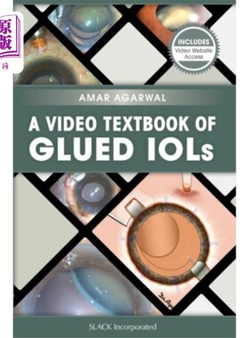 海外直订医药图书Video Textbook of Glued IOLs 胶合人工晶体视频教材