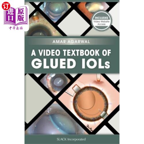 海外直订医药图书Video Textbook of Glued IOLs 胶合人工晶体视频教材