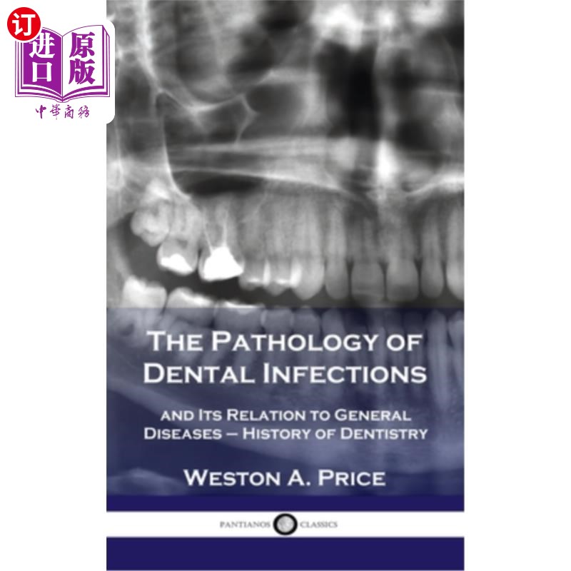 海外直订医药图书Pathology of Dental Infections: and Its Relation to General Diseases- History o牙科感染病理学:及-封面