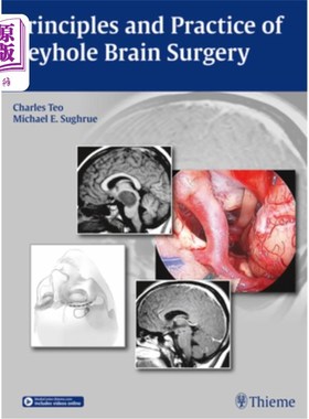 医药图书Principles and Practice of Keyhole Brain Surgery 锁眼脑外科的原理与实践【中商原版】