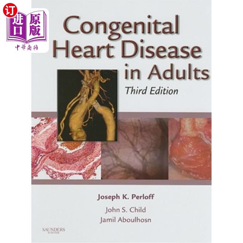 海外直订医药图书Congenital Heart Disease in Adults 成人先天性心脏病