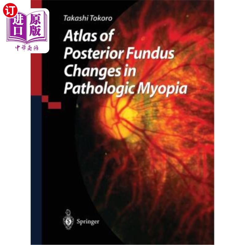 海外直订医药图书Atlas of Posterior Fundus Changes in Pathologic Myopia 病理性近视后眼底改变图谱