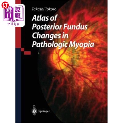 海外直订医药图书Atlas of Posterior Fundus Changes in Pathologic Myopia 病理性近视后眼底改变图谱